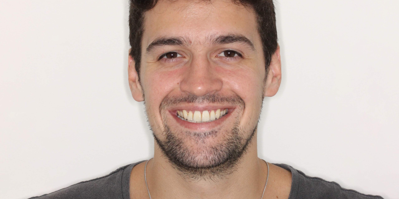 Cirurgia Ortognática e Ortodontia com Aparelho Fixo